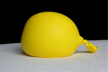 Balloon demonstrating the effect if a flat surface on a babies head